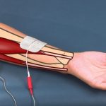 Wrist Flexion