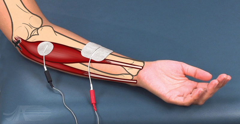 Wrist Flexion
